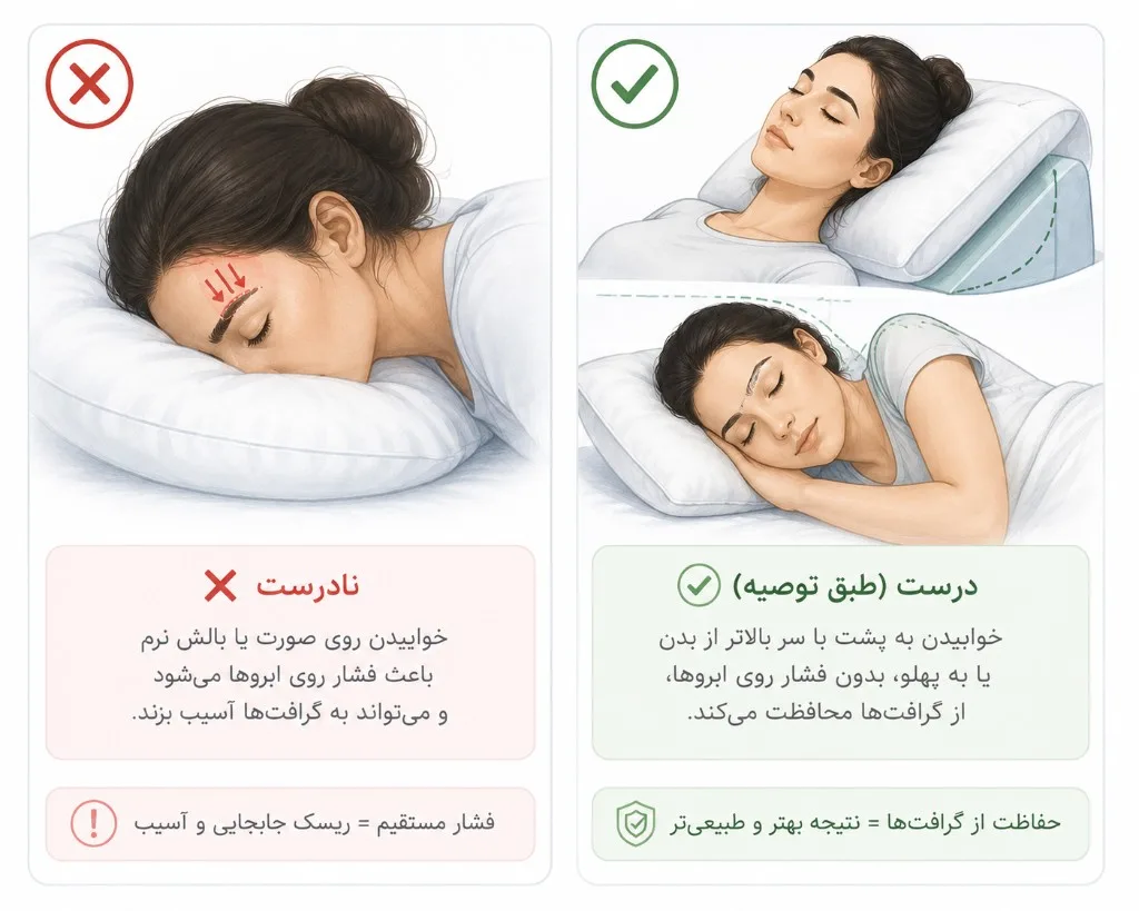 خواب نادرست صورت روی بالش در برابر خواب ایمن به پشت یا پهلو بدون فشار روی ابرو بعد از کاشت