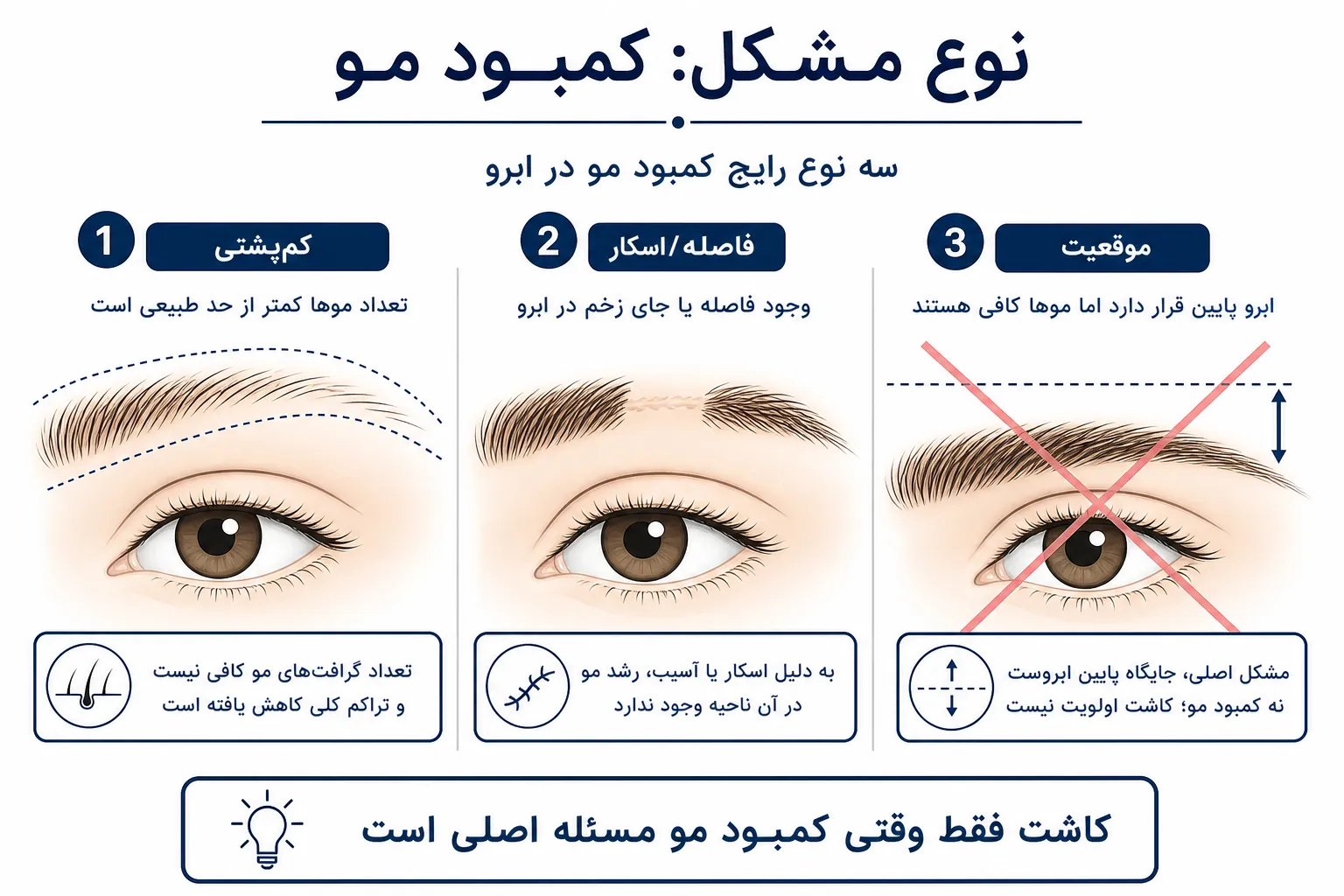 شماتیک انواع مشکل ابرو: کم‌پشتی، فاصله ناشی از اسکار، در برابر مشکل موقعیت که کاشت اولویت اول نیست