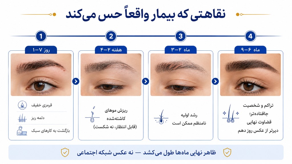 نقاهت کاشت ابرو که بیمار واقعاً حس می‌کند: روز ۱ تا ۷، هفته ۲ تا ۴ ریزش، ماه ۲ تا ۳ رشد اولیه، ماه ۶ تا ۹ تراکم جاافتاده