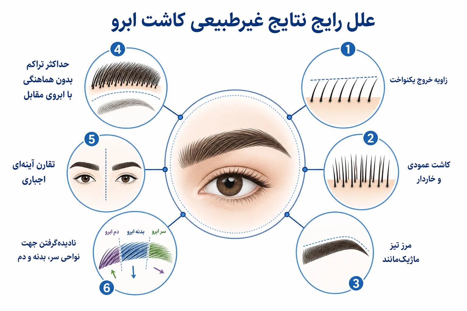 طبقه‌بندی علل رایج نتیجه غیرطبیعی کاشت ابرو