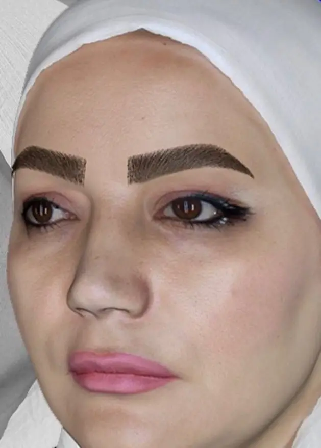 طراحی و کاشت ابرو — بعد